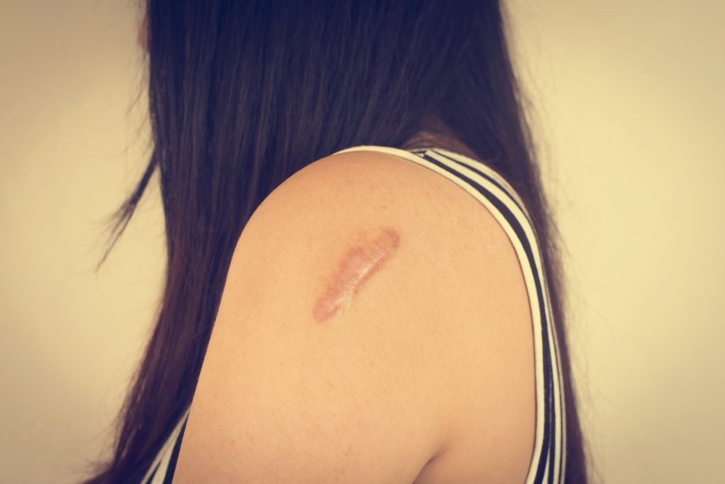 Tamanu oil and its healing power