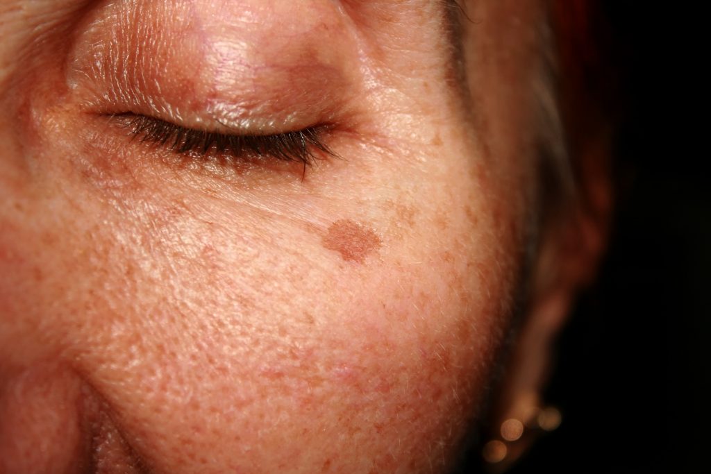 5 utilisations de l'huile de Tamanu pour la peau que vous allez adorer
