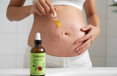 Huile de Tamanu et le traitement des vergetures post-grossesse